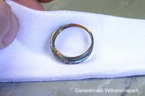 De ring die op de rontgenfoto te zien was